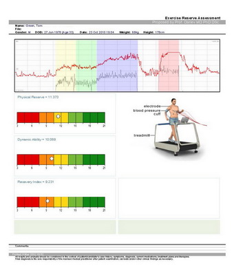 Exercise ECG Analysis
