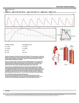 Pulse Wave Velocity Analysis