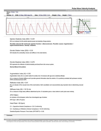 Pulse Wave Velocity Analysis