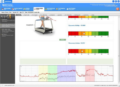 Exercise ECG Analysis