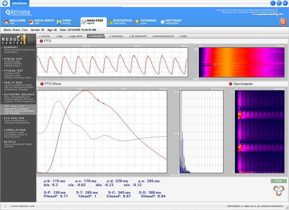 Pulse Wave Velocity Analysis