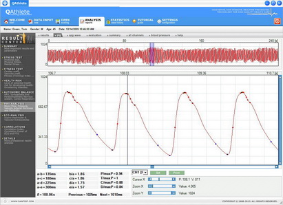 Pulse Wave Velocity Analysis