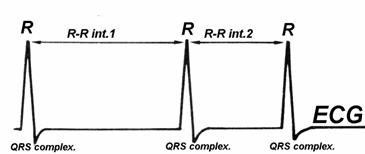 ECG